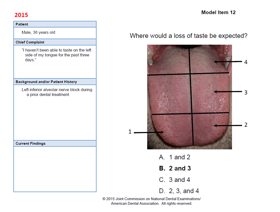 Picture of a human tongue and descriptive chart